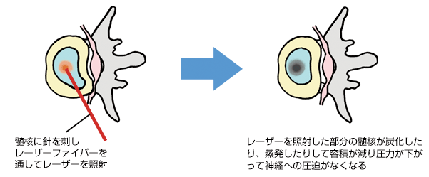 �o��I���[�U�[�ŊԔ����p�i�o�k�c�c)